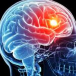 Neurotóxicos están causando una pandemia de trastornos cerebrales